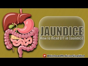 What is Jaundice? Causes, Types, Investigations #jaundice #youtube #medstudent #usmle #neetpg