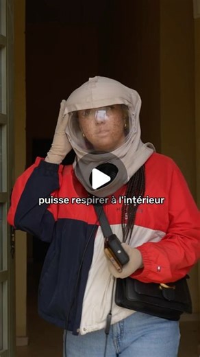 Ummah Charity | Association Humanitaire on Instagram: "Pourquoi « Enfants de la Lune ? »🌙 Les Enfants de la Lune, c’est le surnom donné aux personnes atteintes du Xeroderma Pigmentosum (XP)une maladie génétique rare. 💛 Cette condition rend notre peau extrêmement sensible aux rayons UV, au point que même une exposition minimale au soleil peut causer de graves dommages.😓 🚫Pour vivre « presque normalement », il nous faut : ☀️ Éviter le soleil : Sortir uniquement la nuit ou être complètement cou