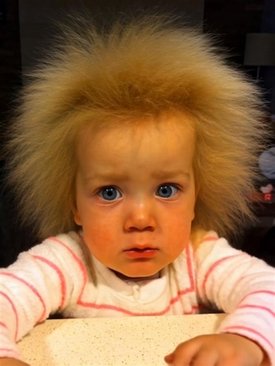 «Vous vous souvenez de la fille atteinte d'un syndrome capillaire rare?» 🧐🫢 Sheila, née avec un syndrome génétique rare qui lui donne des cheveux exceptionnellement épais, est devenue une jeune femme sûre d'elle. Malgré l'attention que suscite sa « crinière de lion », elle assume pleinement sa singularité. Découvrez à quoi elle ressemble aujourd'hui dans les commentaires 👇 | Nouvelles du monde entier