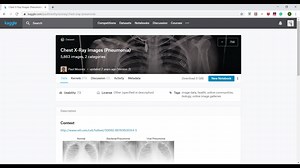 How to design a deep learning model to detect Pneumonia based on chest X-Ray i