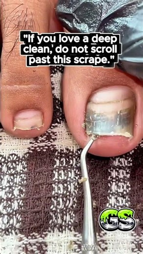 Just Relief🤤#satisfying #asmr #gross #shorts