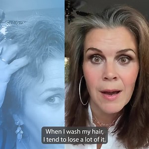 1.6K reactions · 498 shares | When hair follicles are starved of blood supply they die off, leading to hair loss.  Learn how to naturally stimulate blood flow to hair follicles. | Vitality Extracts Essential Oils | Facebook