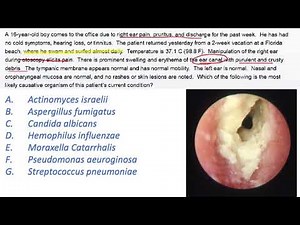 ENT Questions USMLE STEP 2 CK