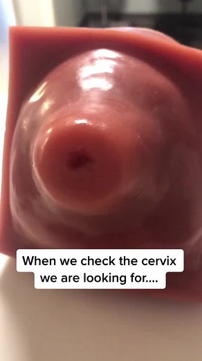 Understanding Cervical Examination Techniques