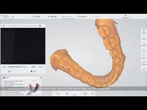 PANDA smart Intraoral Scanner | Restoration Scanning