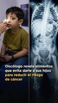 Oncologist Reveals Foods He Avoids Giving His Children to Reduce Cancer Risk