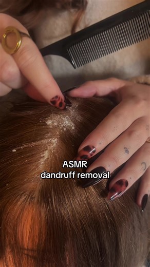 Soothing ASMR Dandruff Removal Experience