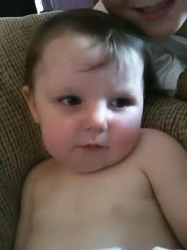 Complex partial seizure toddler