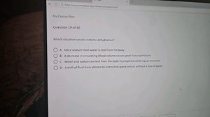 Question 19 of 30Which situation causes isotonic dehydration?... | Filo