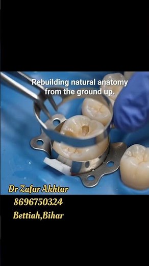 Composite Restoration Matrix Band Placement