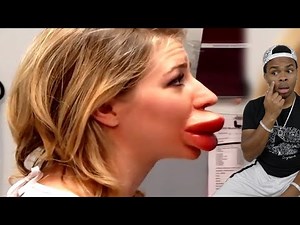 Allergic Reaction GONE WRONG