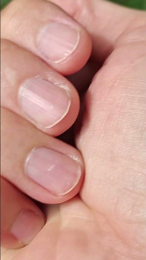 I found the cutest tiny tree frogs in my yard #frog #cute #little #tiny #ispy #nature #found