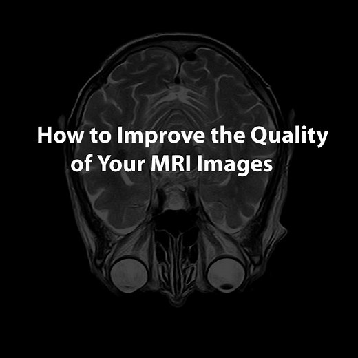 How to Improve the Quality of Your MRI Images - 3DBiology.com