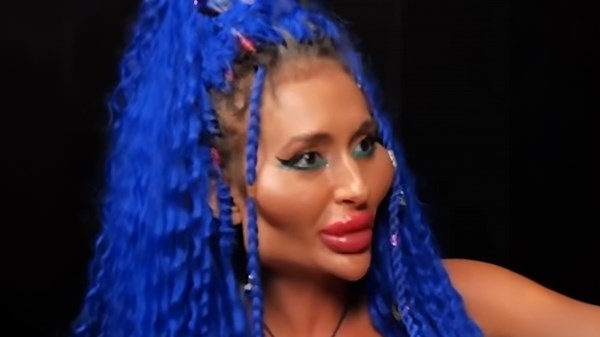 What went wrong in these plastic surgery cases?