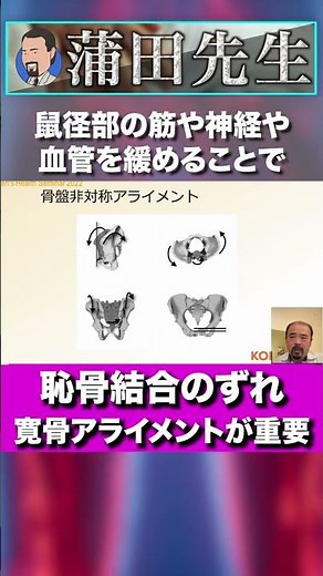 恥骨結合のズレを修正する方法#Short, #セミナー, #セラピスト, #リハビリ, #神経痛, #リハビリ, #解剖学, #柔道整復師, #治療