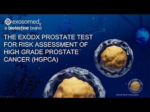The ExoDx Prostate test for Risk Assessment of high grade prostate cancer (HGPCa)