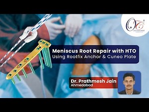 Meniscus Root Repair with HTO | Re-Live Surgery | Surgical Technique Video