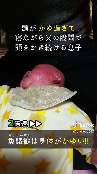 乳児期の息子の悩み：濱口賀久くんの病気と症状