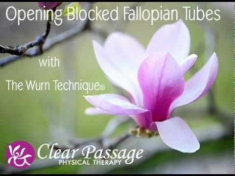 Opening Blocked Fallopian Tubes with the Wurn Technique®