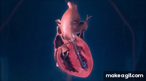 Impella® Heart Pump Animation: For Physicians on Make a GIF