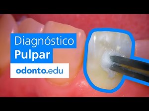 5 métodos para el diagnóstico pulpar - odontoedu