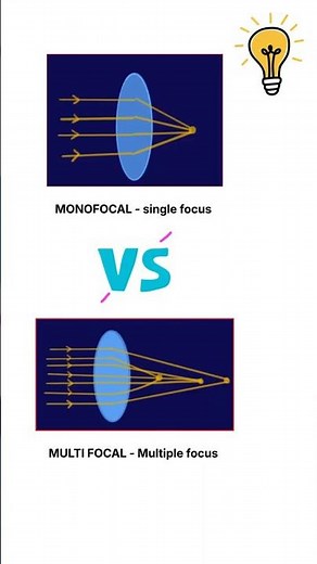 Monofocal vs Multifocal IOL 👁️ | How Many Focus Points Do You REALLY Get?