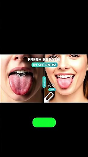 "Top Reasons for Bad Breath & Best Treatments | Halitosis Explained
