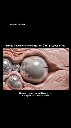 medical / biology explain on Instagram: ""Behold one of modern medicine's greatest miracles: the precise moment of In Vitro Fertilization (IVF) happening right in the lab! In this stunning close-up, a skilled embryologist uses Intracytoplasmic Sperm Injection (ICSI) — injecting a single selected sperm directly into the egg with a microscopic needle. No random chance here; it's cutting-edge science guiding the very first step of life. Once fertilized, the egg begins dividing rapidly — from one ce