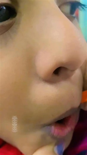 How Speech Tool Helps Correct “R” Sound | Speech Articulation Therapy R Sound Articulation Therapy Using Speech Tool |Speech Tool Therapy for Tongue Placement | R Sound Correction This video shows speech articulation therapy using a speech tool. The therapist is helping the child produce the correct “R” sound instead of “L.” Many children have difficulty with the tongue position and movement needed for the /r/ sound. The speech tool helps guide proper tongue placement, direction, and control, ma