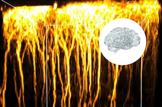 Scientists make live brain transparent