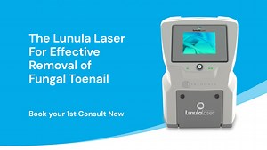 Lunula Laser