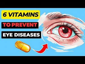 The TOP 6 Vitamins For YOUR EYES