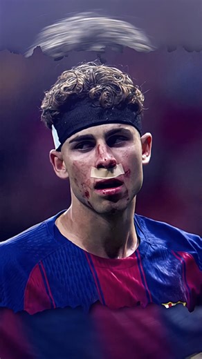 FERMIN LOPEZ BERDARAH SAAT LAWAN ATLETICOMADRID😢