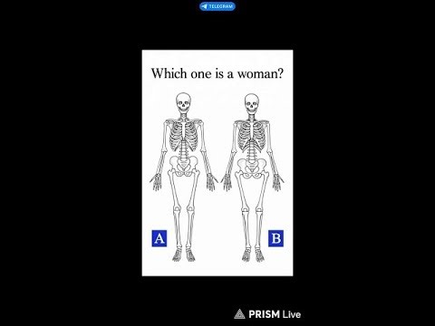 🧠 Find #3 different | 99% Fail This Puzzle
