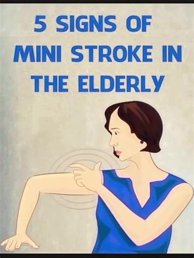 5.7K views | 5 signs of mini str0ke in the elderly Check 1st comment  | Living is the Best | Facebook