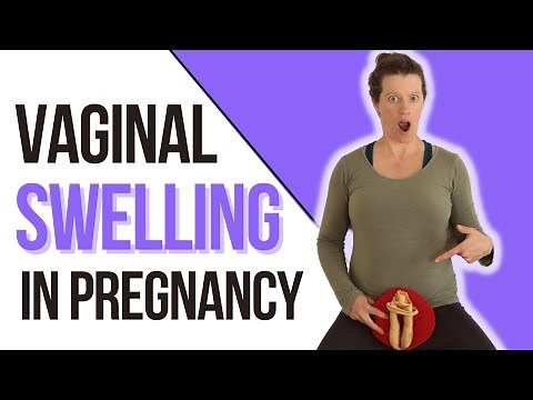 Relieve VAGINAL SWELLING during pregnancy