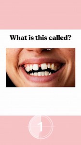 What is called | Learn English with Pictures #EnglishVocabulary#CarLogos#LearnEnglish#quiz #viral | Flash English