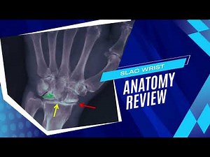 SLAC Wrist - Watson Test