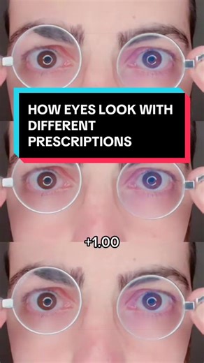 Ever notice how some glasses make eyes look bigger? That’s because plus lenses magnify the appearance of your eyes. Plus lenses are used to help with farsightedness, focusing strain, or near vision demands. The optics bend light differently, which can make the eyes appear larger to someone looking at you, even though nothing about your actual eye size has changed. Just another reminder that lenses don’t only change how you see the world; they can also change how the world sees your eyes. 📍 Vivi
