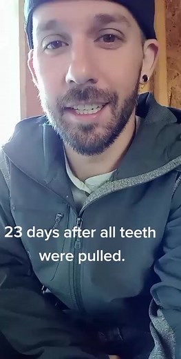 23 days later. #fypシ #fyp #foryourpage #dentalsurgery #dentures #andGO