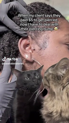 Piercing Bump Treatment for Flawless Piercing Journey