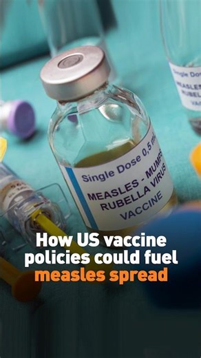 How US vaccine policies could fuel measles spread