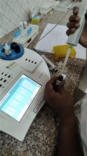 “PT & APTT Test | Blood Coagulation Profile | Lab Procedure Explained”#bloodtest