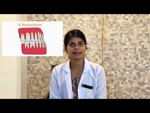 Angle's Classification of Malocclusion Modifications by Dewey and Leischer