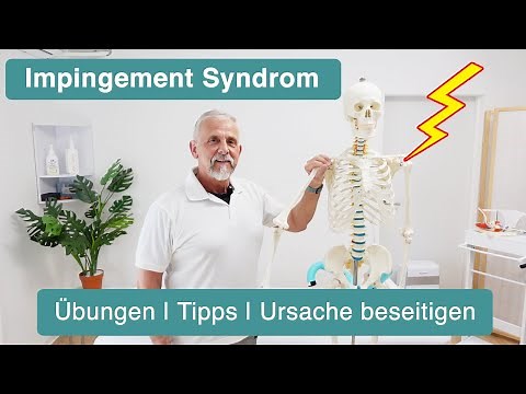 Shoulder impingement syndrome ✅ Causes, exercises & shoulder support explained (including univers...