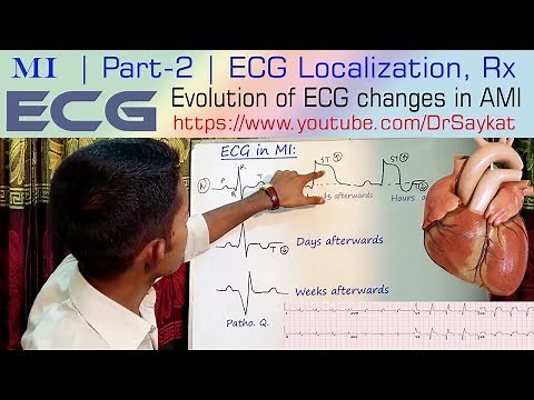MI | Part 2 | ECG Localization & Treatment of Myocardial Infarction | Dr. Saykat