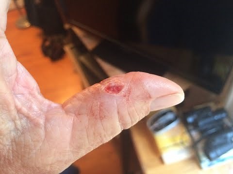 LIQUID BANDAGE Type Products - Use Including results post 1 week.