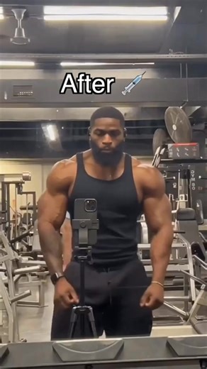 Before After 💉 | Tibo Inshape