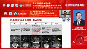 PI-RADS v2.1解读及病例实战演练_同济大学附属同济医院王培军