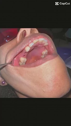 deansimplants on TikTok